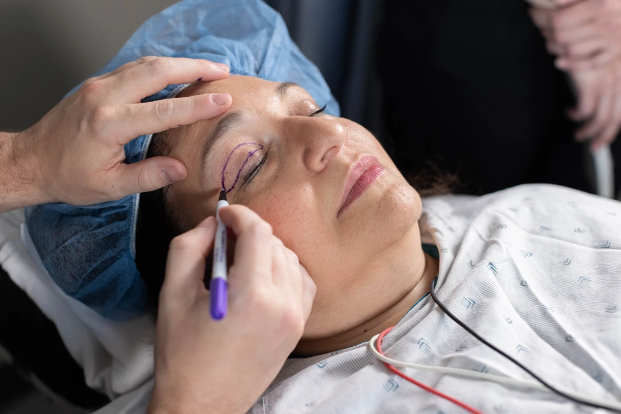 Patient preparing for a blepharoplasty